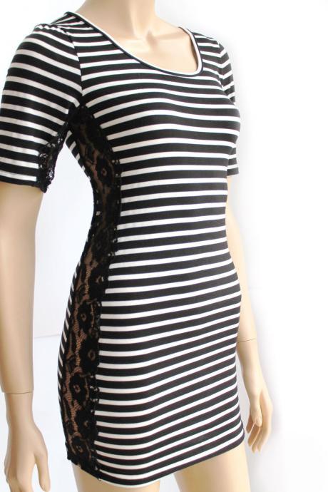Black and white / cotton/women's Striped casual /mini dress/ tunic